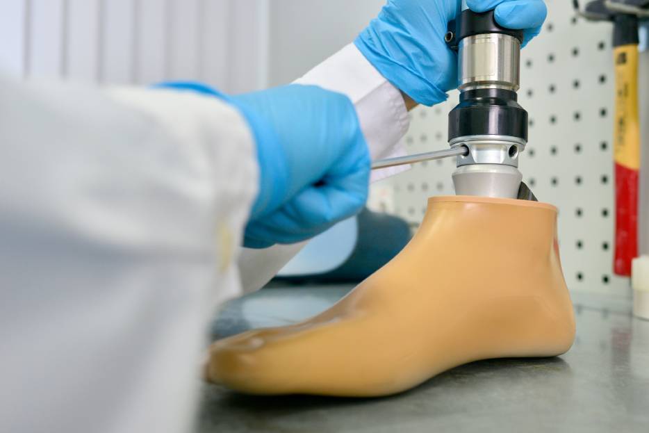 Cómo elegir el mejor fabricante de prótesis en León, Guanajuato