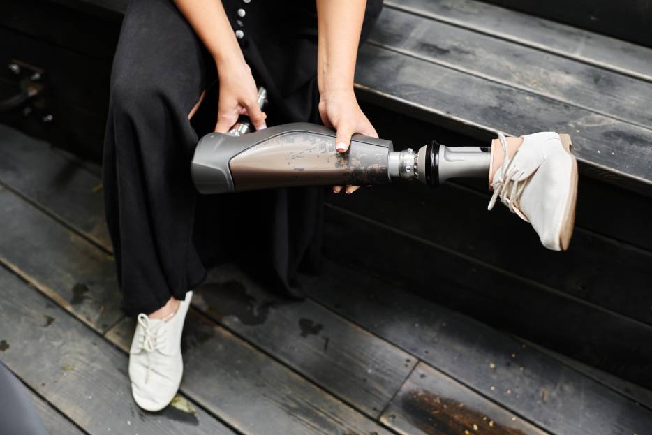 mujer con prótesis de pierna