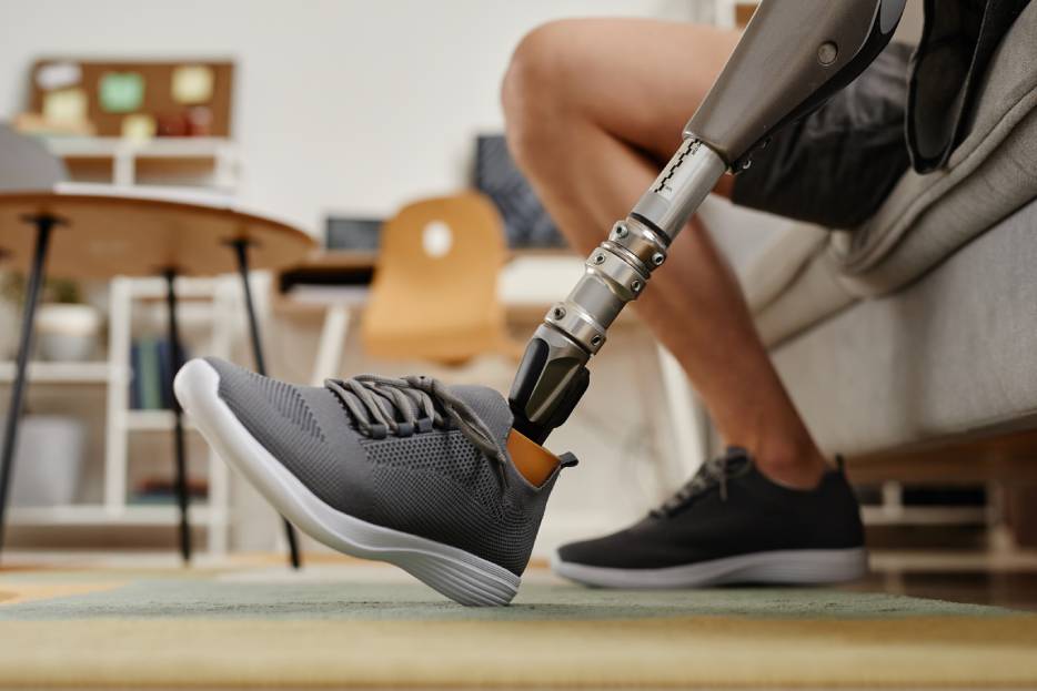 paciente con prótesis de pierna en un consultorio