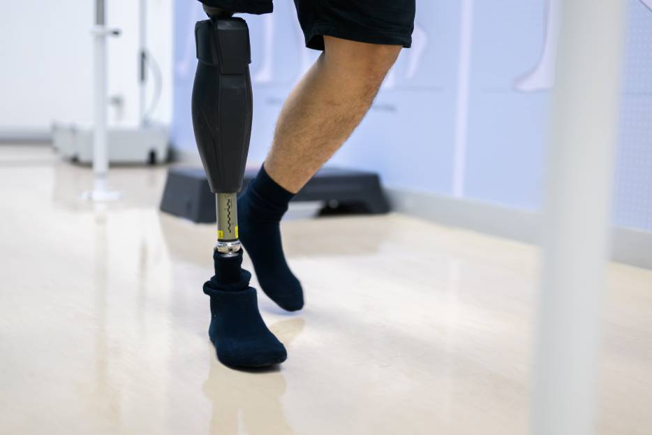 rehabilitación con prótesis de pierna
