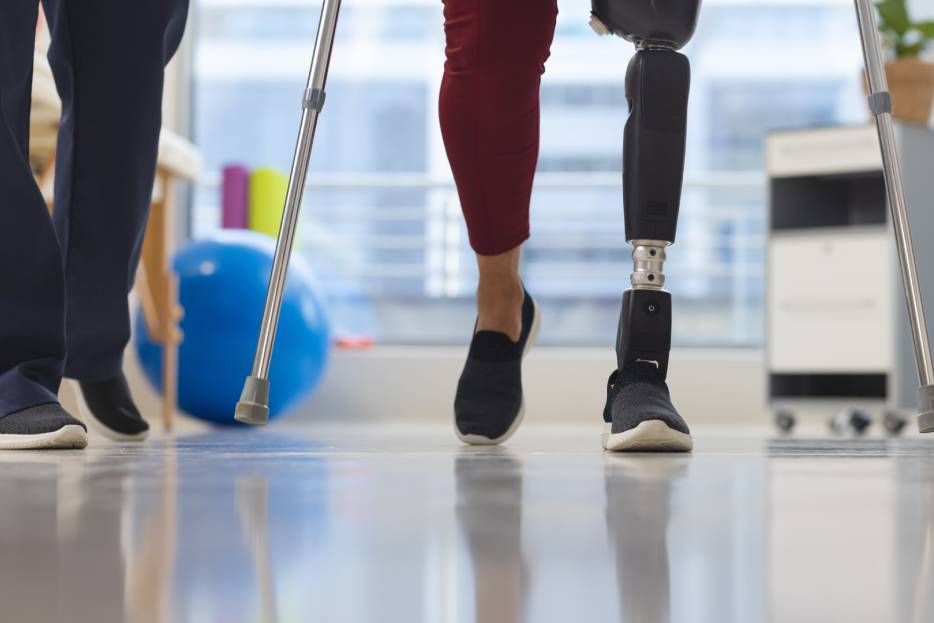 paciente en proceso de rehabilitación con prótesis