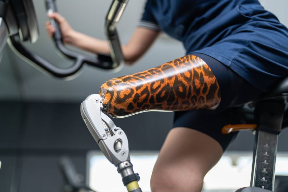 Elegir prótesis de pierna para deportistas adecuadas depende del tipo de disciplina, la biomecánica del atleta y las exigencias del movimiento.