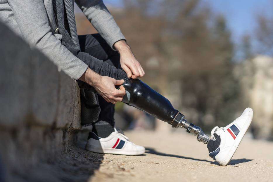 Diferencias entre prótesis transtibiales y transfemorales: ¿Cuál necesitas?