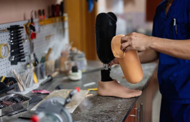 ¿Cómo es la fabricación de una prótesis de pierna paso a paso?
