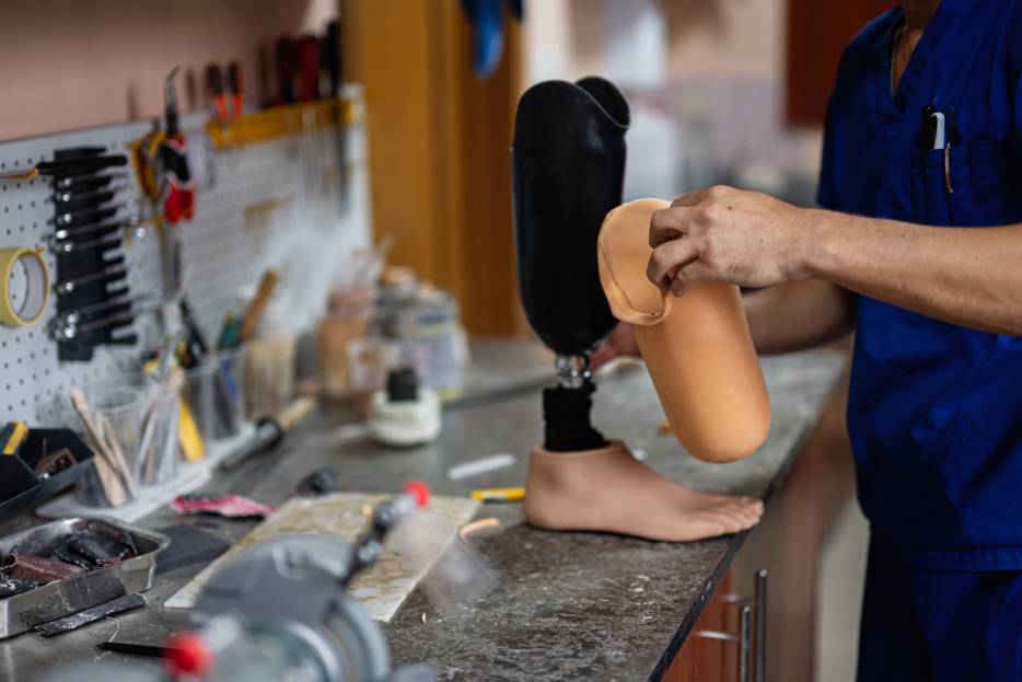 ¿Cómo es la fabricación de una prótesis de pierna paso a paso?