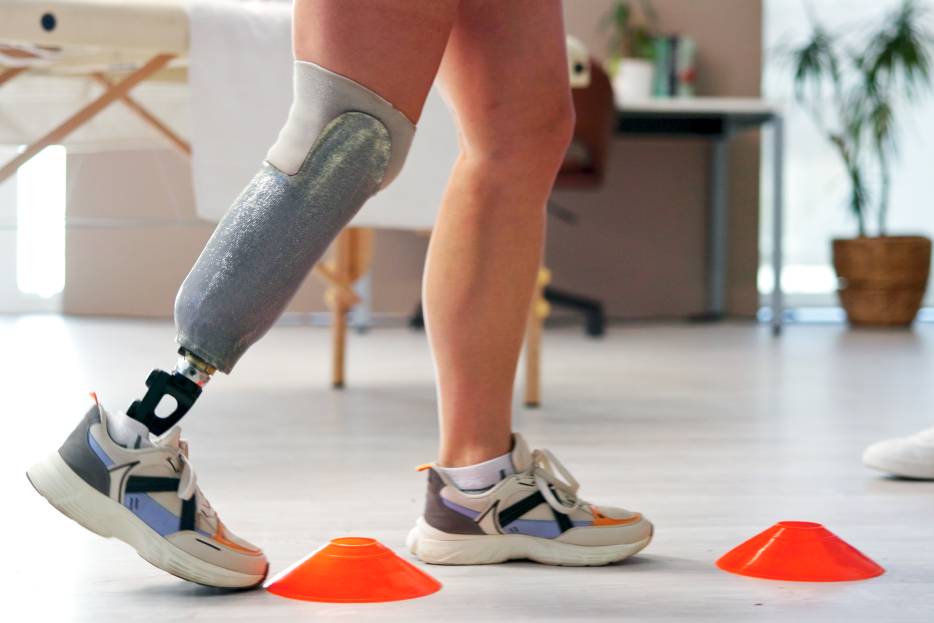rehabilitación física para adaptación de prótesis